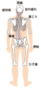 骨格の歪み