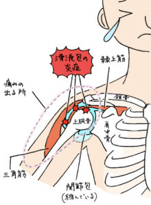 五十肩