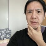 顎関節症
