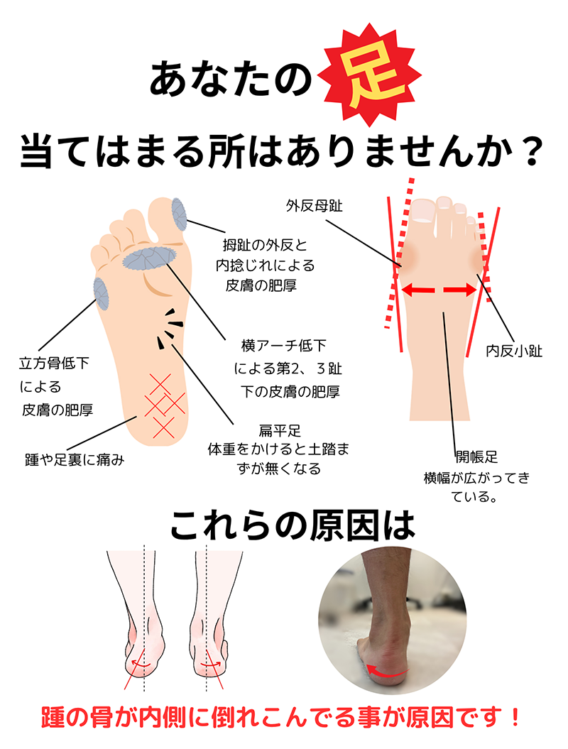 足裏の解説