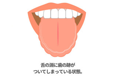 自分の舌をチェック